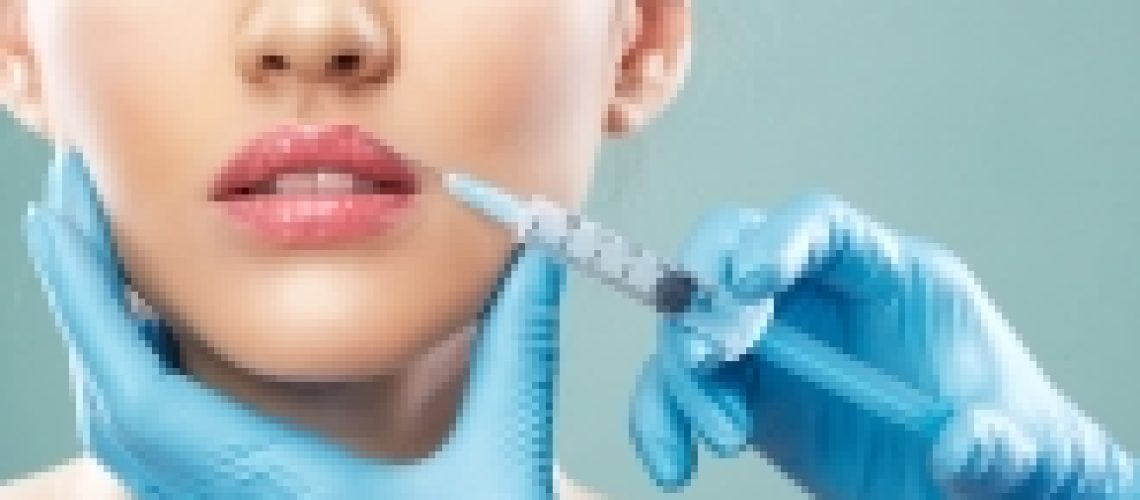 acide hyaluronique volume levres toulouse beauzelle