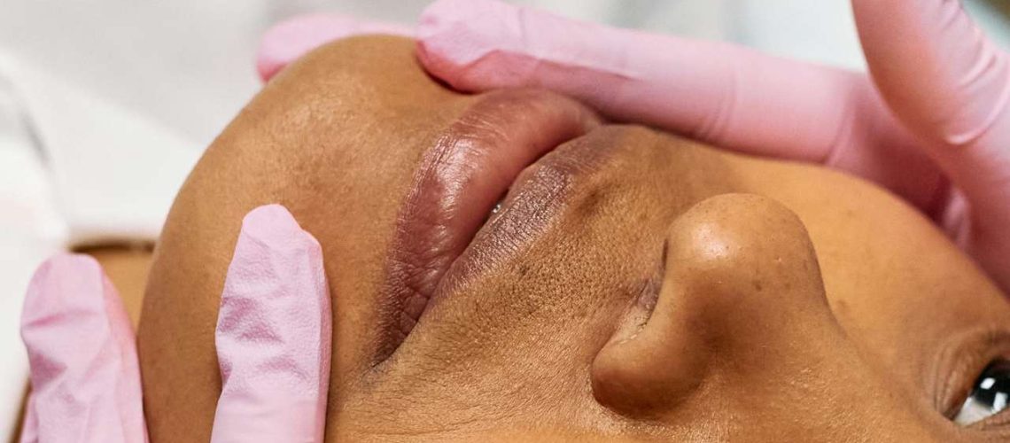 est ce que acide hyaluronique peut migrer